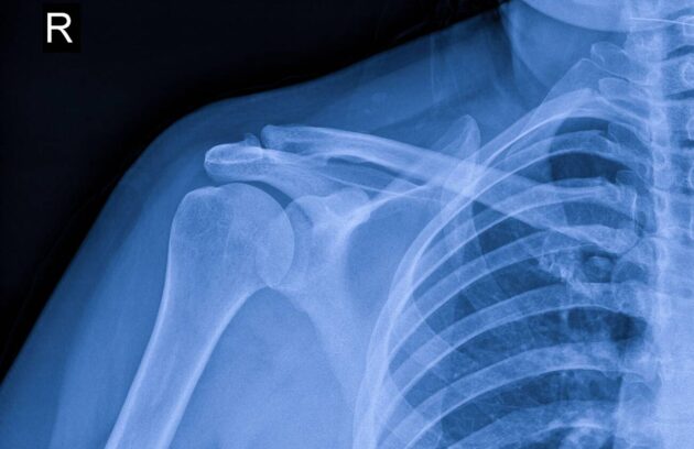 General Surgery